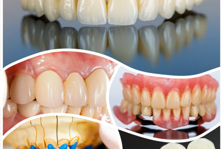 A collage made of photos of modern dental products and solutions vastly used on social media.
